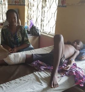 Read more about the article Young student with broken leg assisted with medical bills payment and moral support￼